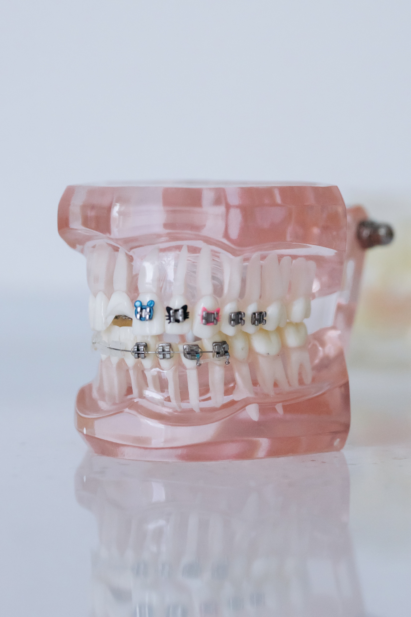 Zobni aparat – vrste, učinki, prednosti in slabosti